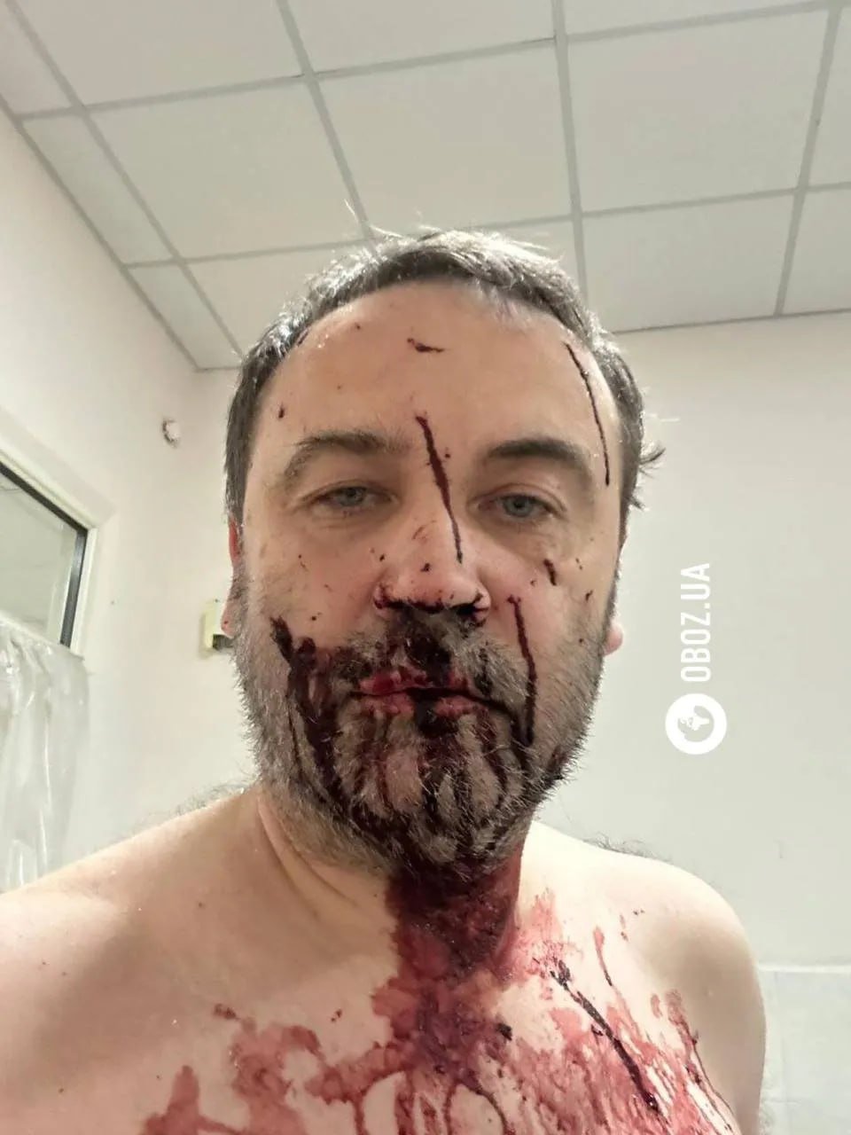 Photo: Obozrevatel.ua